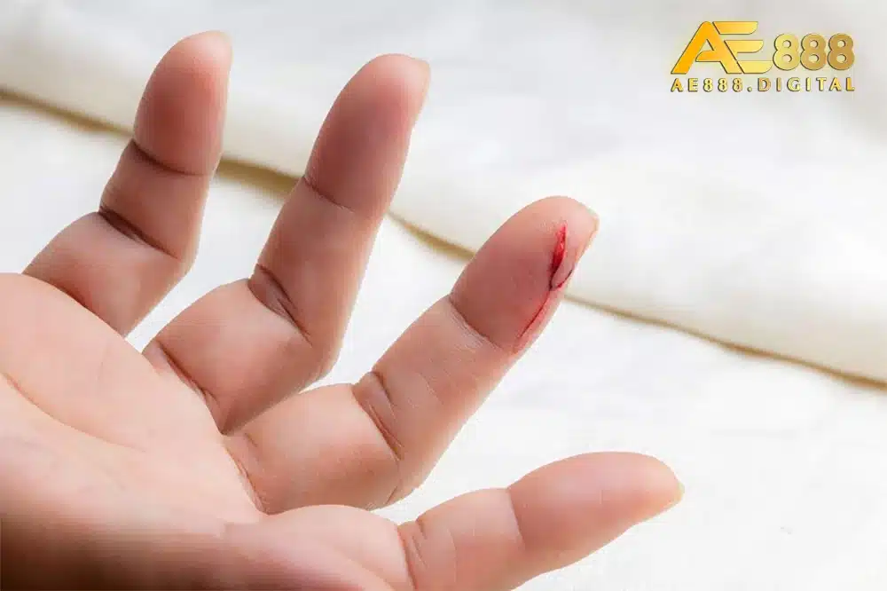 Theo kinh nghiệm của nhiều cao thủ lô đề, mơ thấy máu cũng mang nhiều điềm lành nếu biết cách đánh số hợp lý