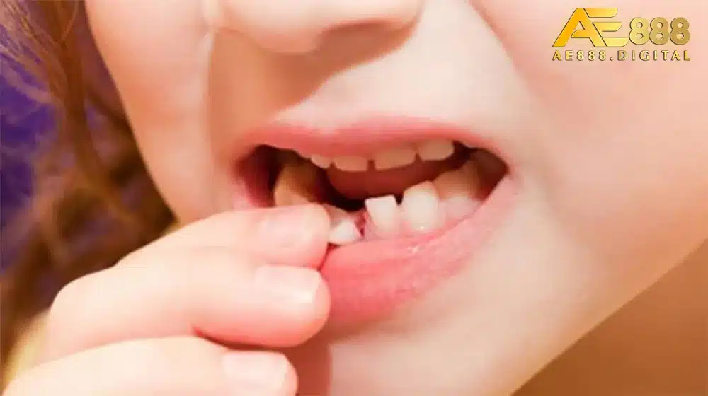 Rụng răng trong các giấc mơ thường mang đến cảm giác khó chịu, sợ hãi cho người nằm mơ. Tuy nhiên, đây lại là hiện tượng rất phổ biến ở người trưởng thành